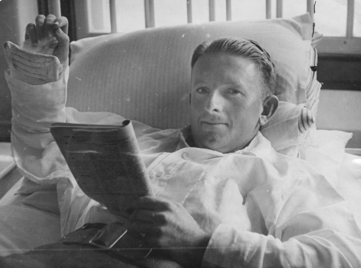 Pte. R.J. Owens (Footscray) had his arm broken when he was hit by a falling cocoanut [i.e. coconut] at Milne Bay (c. 1943)
