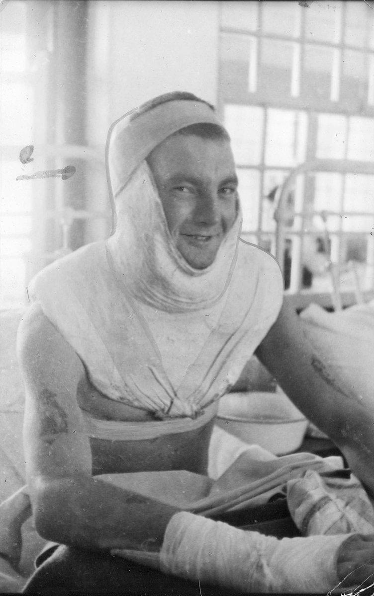 Gnr. R. Schafer of North Fitzroy wears this cast in recovering from an injured vertexbrae [i.e. vertebrae], Fitzroy North (c. 1943)