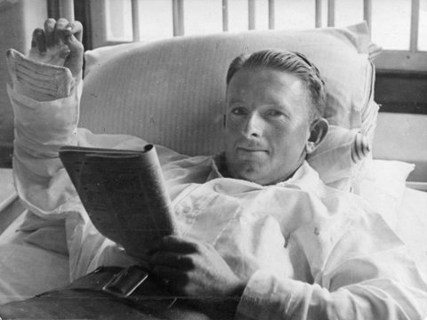 Pte R. J. Owens, Footscray, had his arm broken when he was hit by a falling coconut at Milne Bay, c. 1943